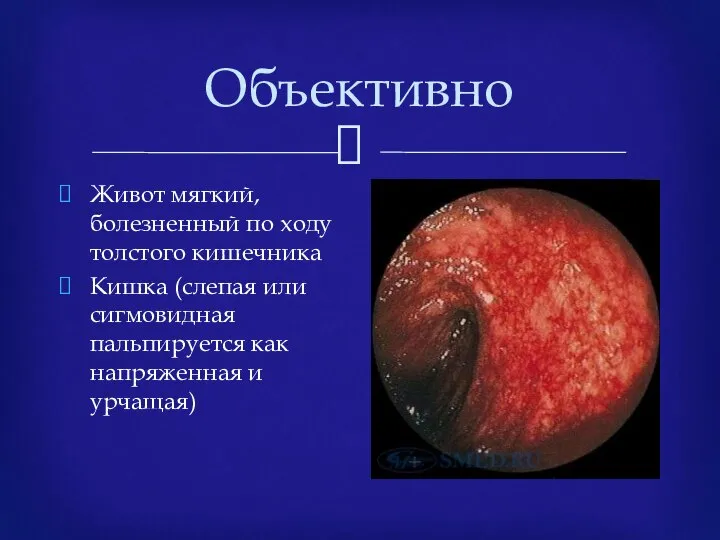 Объективно Живот мягкий, болезненный по ходу толстого кишечника Кишка (слепая или