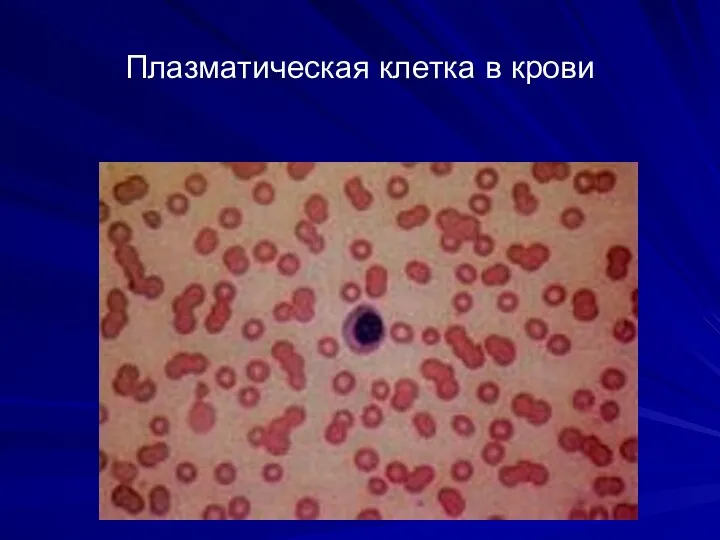 Плазматическая клетка в крови