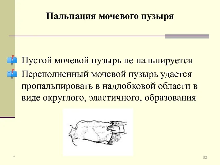 Пустой мочевой пузырь не пальпируется Переполненный мочевой пузырь удается пропальпировать в