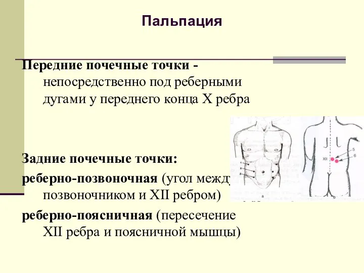 Пальпация Передние почечные точки - непосредственно под реберными дугами у переднего