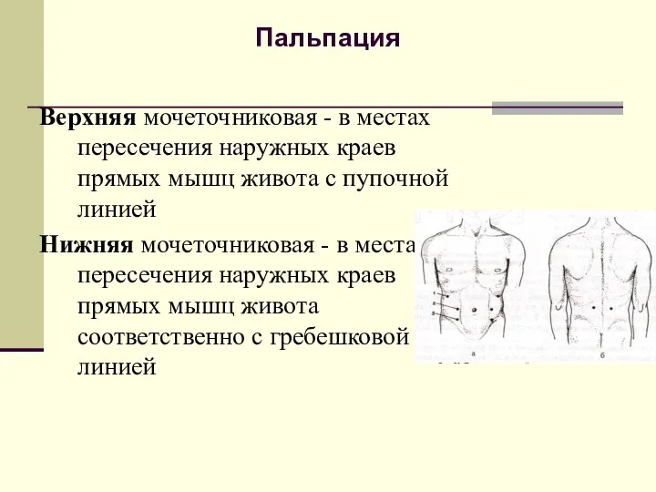 Пальпация Верхняя мочеточниковая - в местах пересечения наружных краев прямых мышц