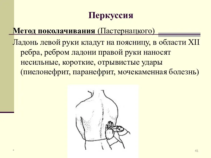 Перкуссия Метод поколачивания (Пастернацкого) Ладонь левой руки кладут на поясницу, в