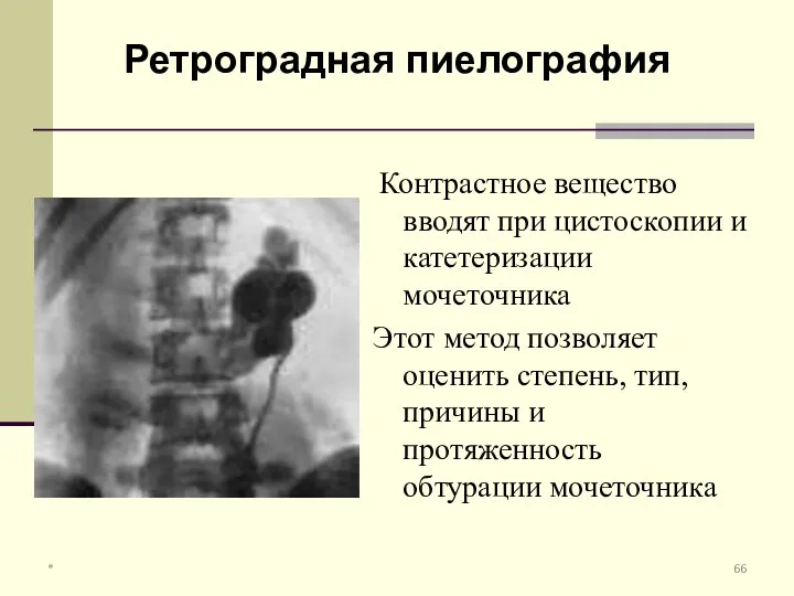 Контрастное вещество вводят при цистоскопии и катетеризации мочеточника Этот метод позволяет