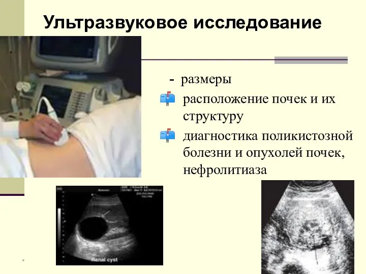 - размеры расположение почек и их структуру диагностика поликистозной болезни и