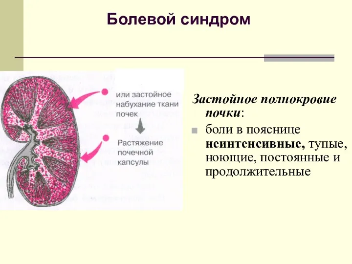 Болевой синдром Застойное полнокровие почки: боли в пояснице неинтенсивные, тупые, ноющие, постоянные и продолжительные