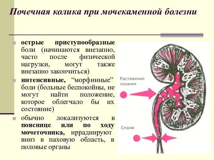 Почечная колика при мочекаменной болезни острые приступообразные боли (начинаются внезапно, часто