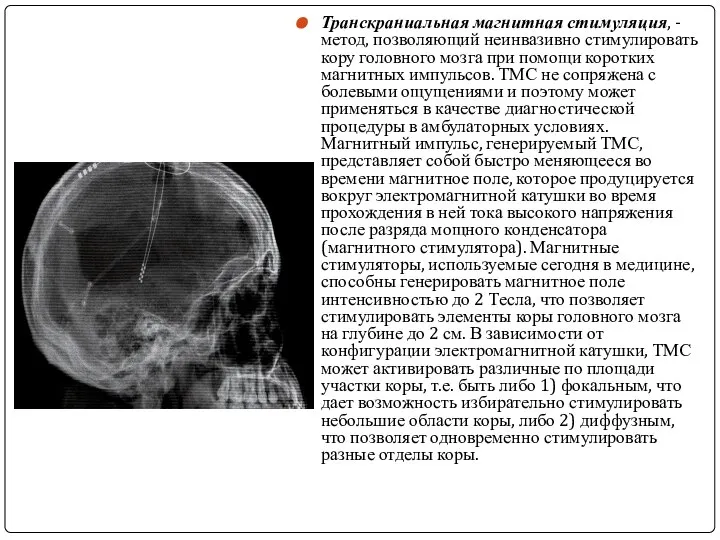 Транскраниальная магнитная стимуляция, - метод, позволяющий неинвазивно стимулировать кору головного мозга