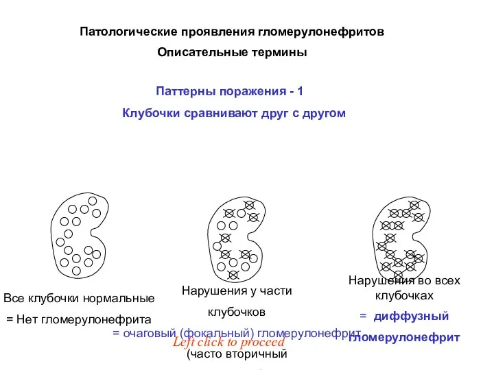 Патологические проявления гломерулонефритов Описательные термины Паттерны поражения - 1 Left click