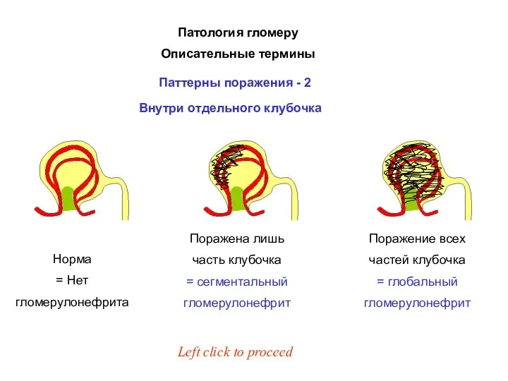 Патология гломеру Описательные термины Паттерны поражения - 2 Left click to proceed Внутри отдельного клубочка