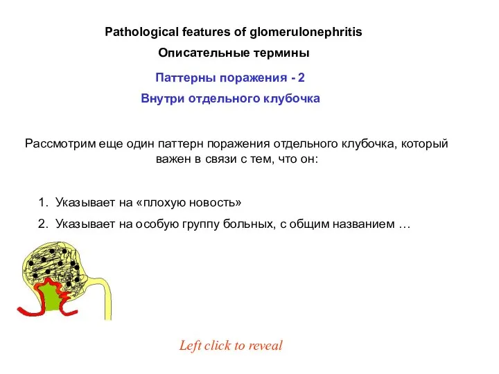 Рассмотрим еще один паттерн поражения отдельного клубочка, который важен в связи