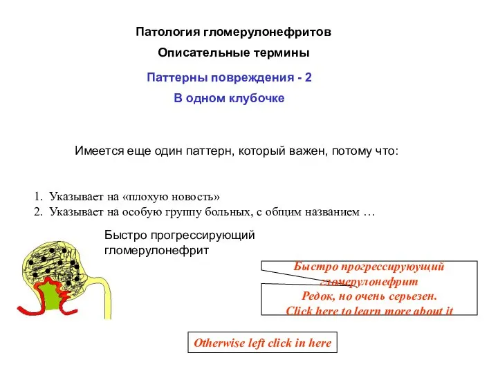 Имеется еще один паттерн, который важен, потому что: 1. Указывает на