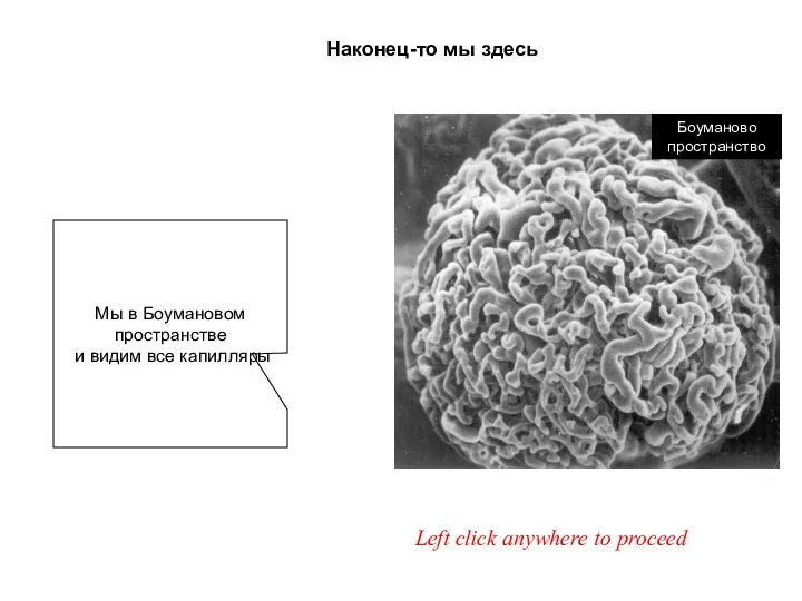 Наконец-то мы здесь Left click anywhere to proceed Мы в Боумановом пространстве и видим все капилляры