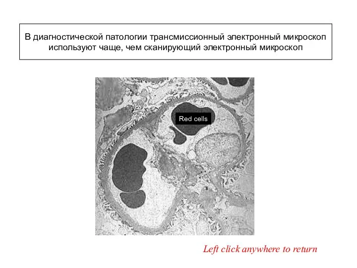 Red cells Left click anywhere to return В диагностической патологии трансмиссионный