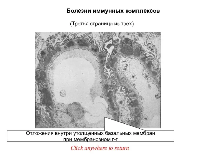Болезни иммунных комплексов Click anywhere to return (Третья страница из трех)