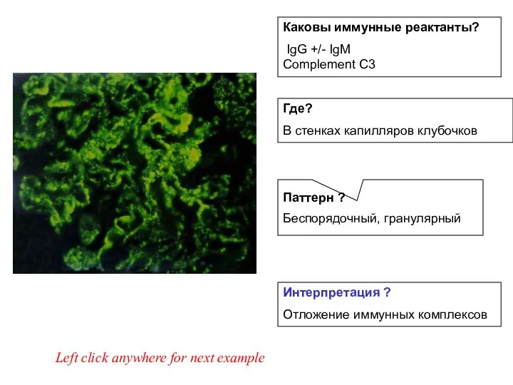 Каковы иммунные реактанты? IgG +/- IgM Complement C3 Left click anywhere