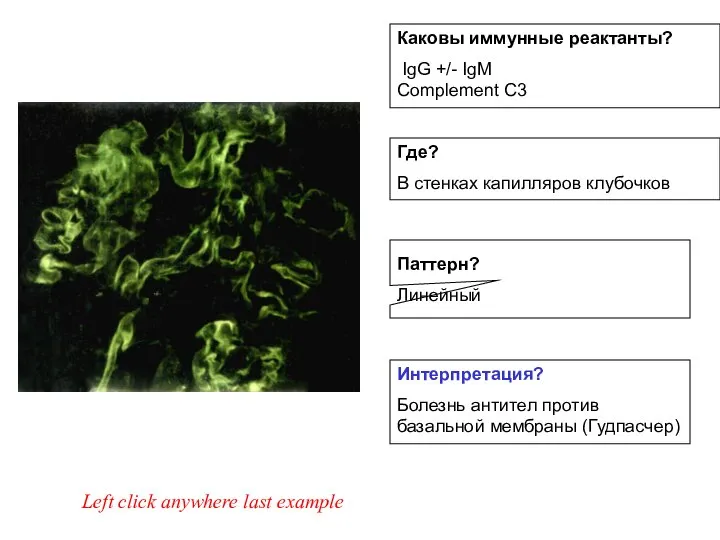 Left click anywhere last example Интерпретация? Болезнь антител против базальной мембраны