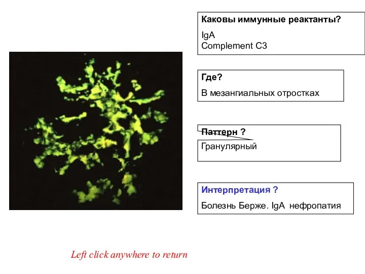 Left click anywhere to return Интерпретация ? Болезнь Берже. IgA нефропатия