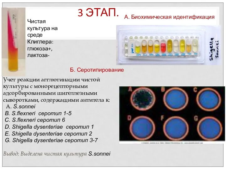 3 ЭТАП. Учет реакции агглютинации чистой культуры с монорецепторными адсорбированными шигеллезными