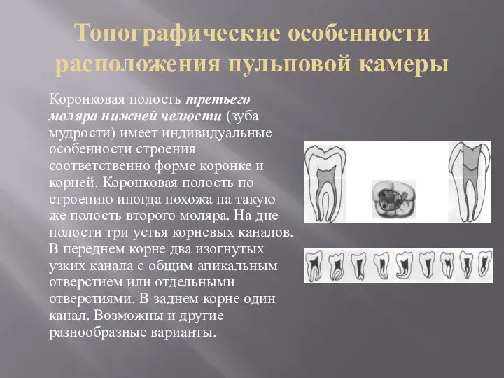 Топографические особенности расположения пульповой камеры Коронковая полость третьего моляра нижней челюсти