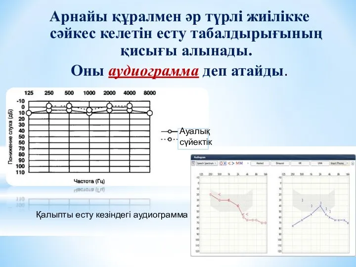 Арнайы құралмен әр түрлі жиілікке сәйкес келетін есту табалдырығының қисығы алынады.