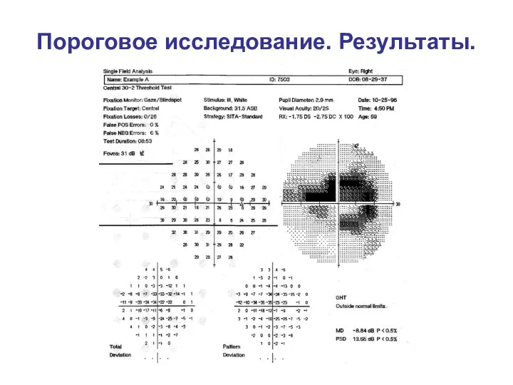 Пороговое исследование. Результаты.