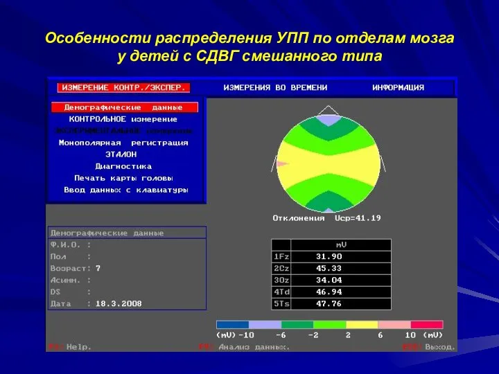 Особенности распределения УПП по отделам мозга у детей с СДВГ смешанного типа