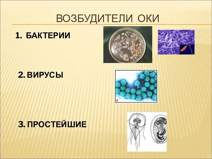 ВОЗБУДИТЕЛИ ОКИ БАКТЕРИИ 2. ВИРУСЫ 3. ПРОСТЕЙШИЕ