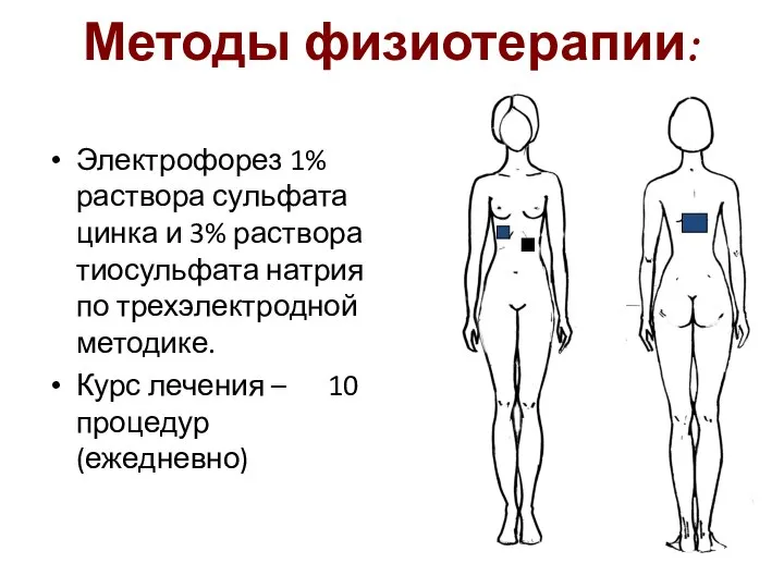 Методы физиотерапии: Электрофорез 1% раствора сульфата цинка и 3% раствора тиосульфата