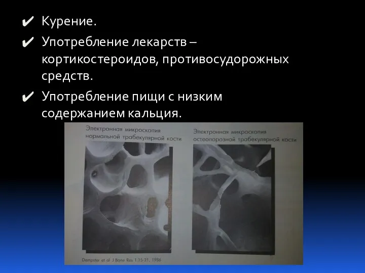 Курение. Употребление лекарств – кортикостероидов, противосудорожных средств. Употребление пищи с низким содержанием кальция.