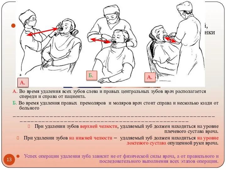 Операция удаления зуба Удаление зуба заключается в насильственном разрыве тканей, находящихся