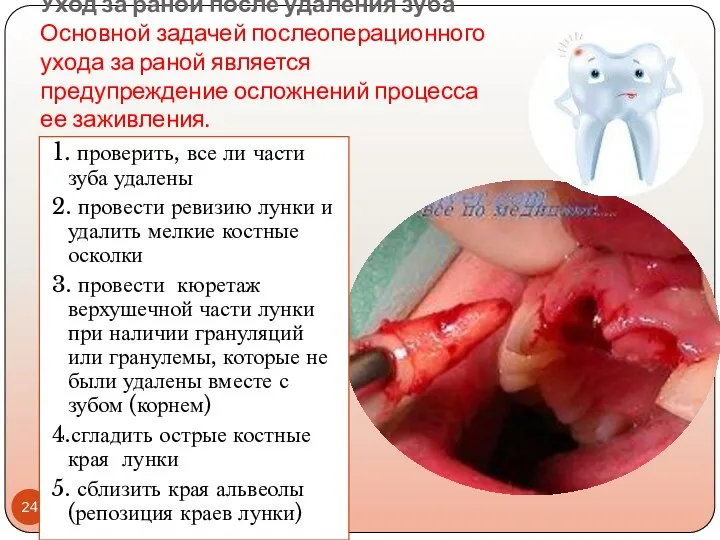 Уход за раной после удаления зуба Основной задачей послеоперационного ухода за