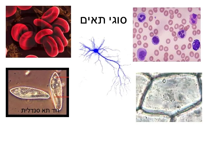 סוגי תאים חד תא סנדלית