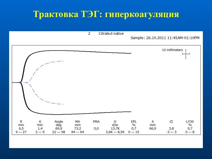 Трактовка ТЭГ: гиперкоагуляция