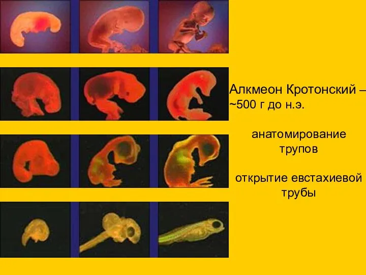 Алкмеон Кротонский – ~500 г до н.э. анатомирование трупов открытие евстахиевой трубы