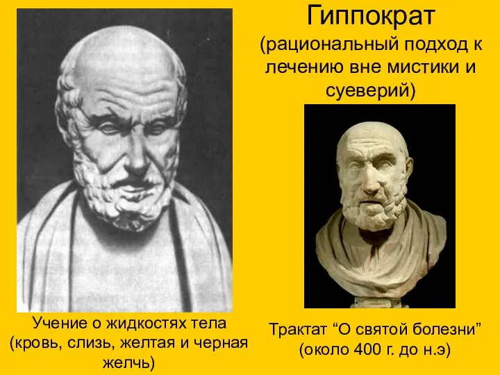 Трактат “О святой болезни” (около 400 г. до н.э) Гиппократ (рациональный