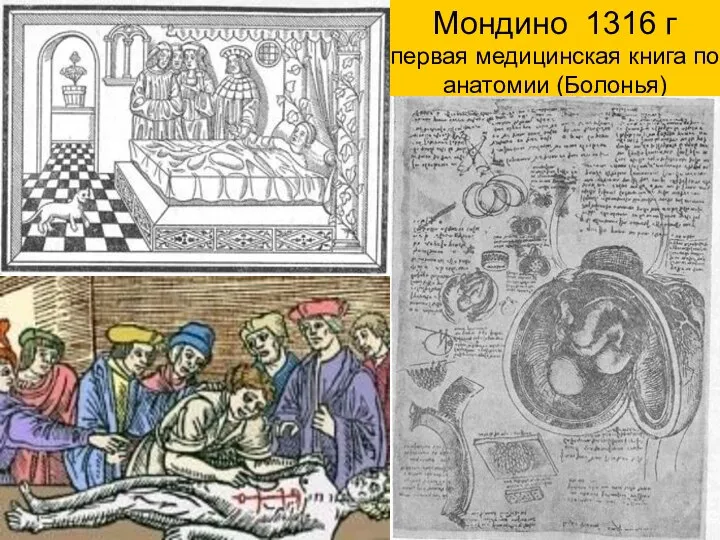 Мондино 1316 г первая медицинская книга по анатомии (Болонья)