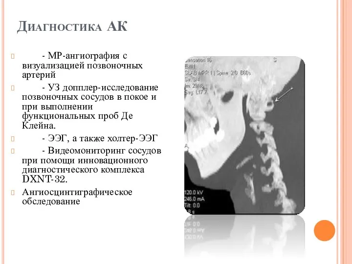 Диагностика АК - МР-ангиография с визуализацией позвоночных артерий - УЗ допплер-исследование