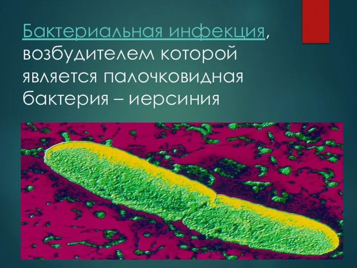 Бактериальная инфекция, возбудителем которой является палочковидная бактерия – иерсиния