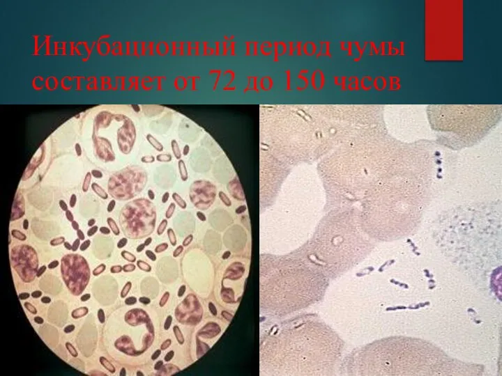 Инкубационный период чумы составляет от 72 до 150 часов