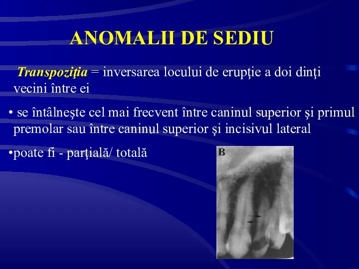 ANOMALII DE SEDIU Transpoziţia = inversarea locului de erupţie a doi