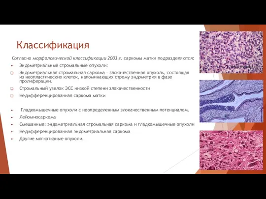 Классификация Согласно морфологической классификации 2003 г. саркомы матки подразделяются: Эндометриальные стромальные