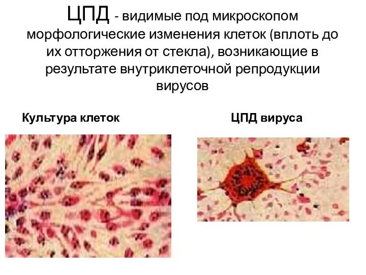 ЦПД - видимые под микроскопом морфологические изменения клеток (вплоть до их