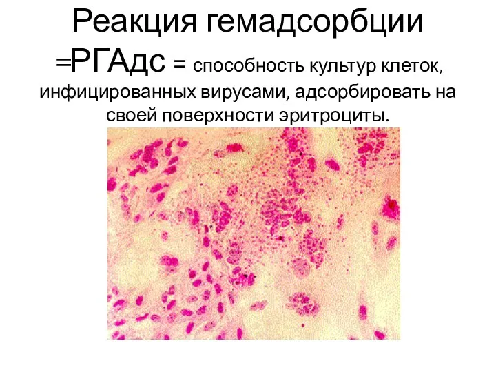 Реакция гемадсорбции =РГАдс = способность культур клеток, инфицированных вирусами, адсорбировать на своей поверхности эритроциты.