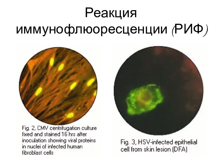 Реакция иммунофлюоресценции (РИФ)