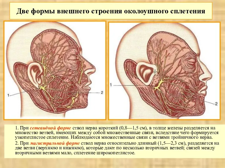 Две формы внешнего строения околоушного сплетения 1. При сетевидной форме ствол