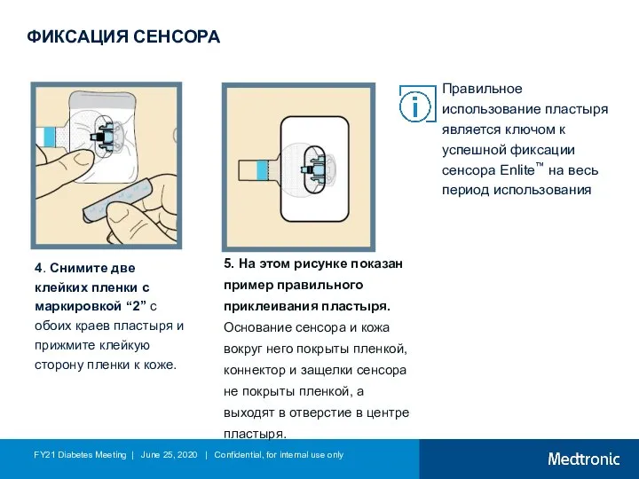 ФИКСАЦИЯ СЕНСОРА 4. Снимите две клейких пленки с маркировкой “2” с