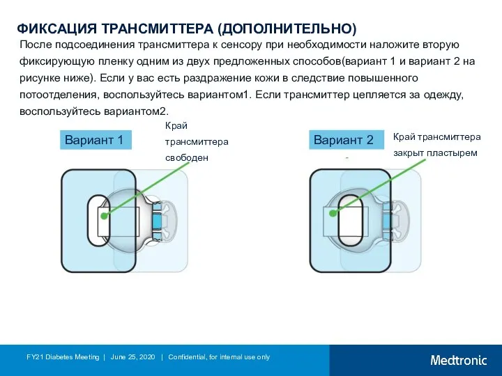 ФИКСАЦИЯ ТРАНСМИТТЕРА (ДОПОЛНИТЕЛЬНО) После подсоединения трансмиттера к сенсору при необходимости наложите