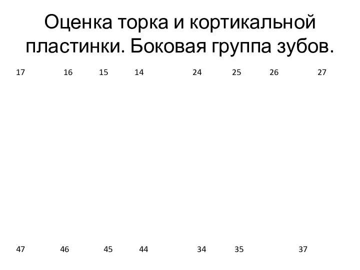 Оценка торка и кортикальной пластинки. Боковая группа зубов. 17 16 15