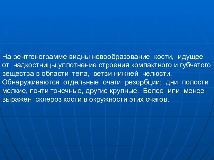 На рентгенограмме видны новообразование кости, идущее от надкостницы,уплотнение строения компактного и