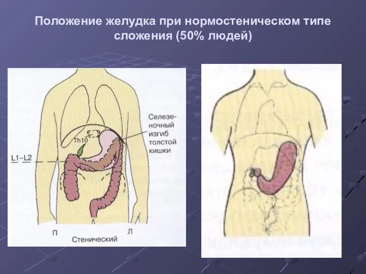 Положение желудка при нормостеническом типе сложения (50% людей)